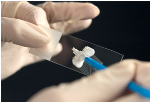 Tato-test na infekcję wirus brodawczaka ludzkiego